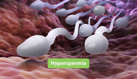 mega sperma|Hyperspermia: Definition, Symptoms, Causes, Treatment, Coping.